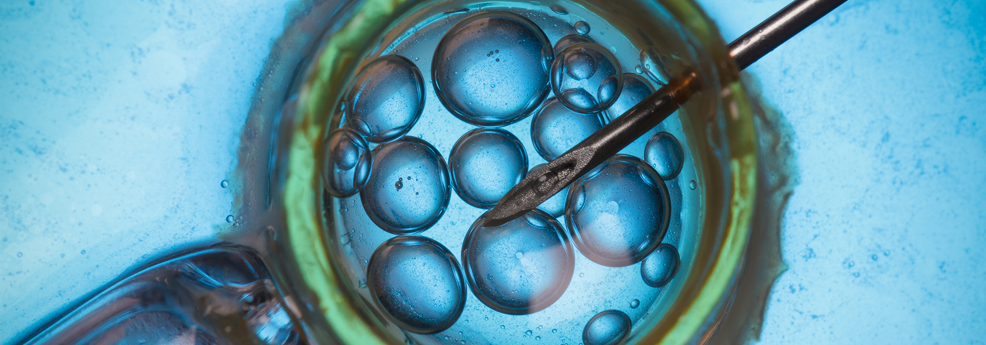 Should-we-publicly-fund-IVF-in-Canada