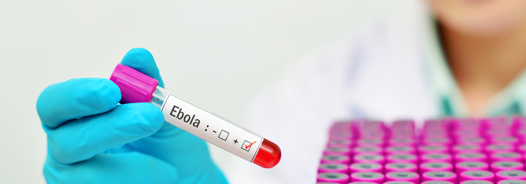 WordPress-Image-hoffman-ebola