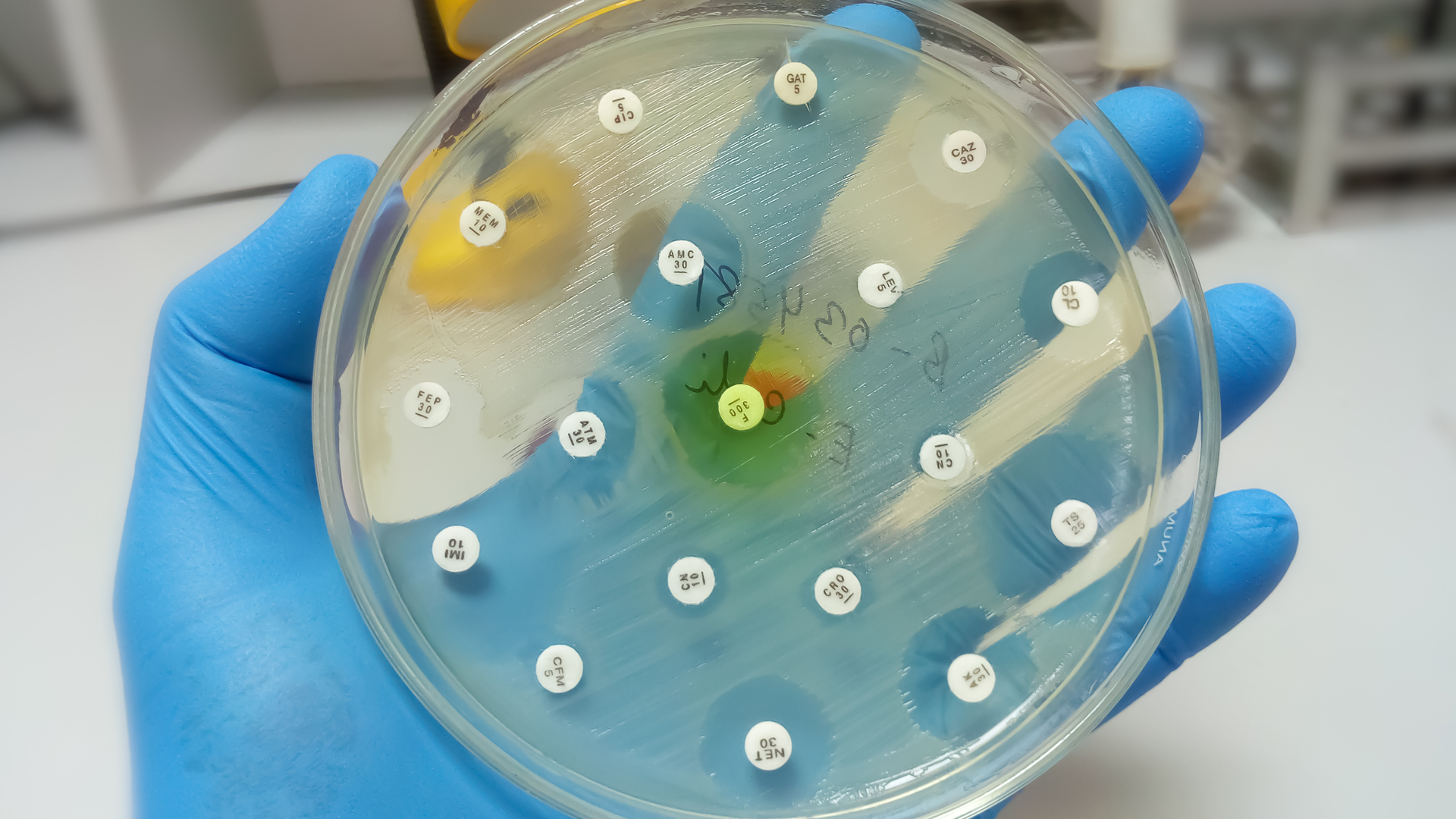 Wordpress-Canada-must-act-to-prevent-growth-of-drug-resistant-infections-